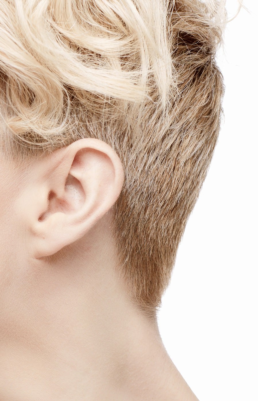 oreilles otoplastie chirurgie  geneve fribourg