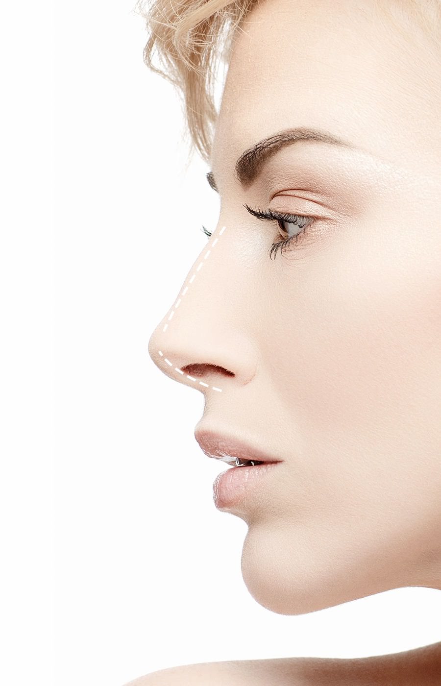 rhinoplastie nez genève fribourg